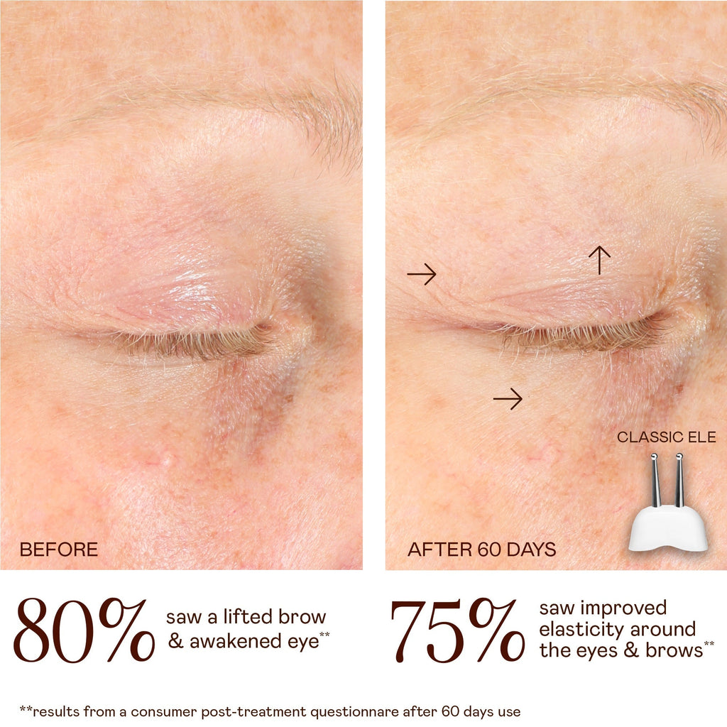 TRINITY CLassic Lifting & Smoothing Lip & Eye Microcurrent Attachment