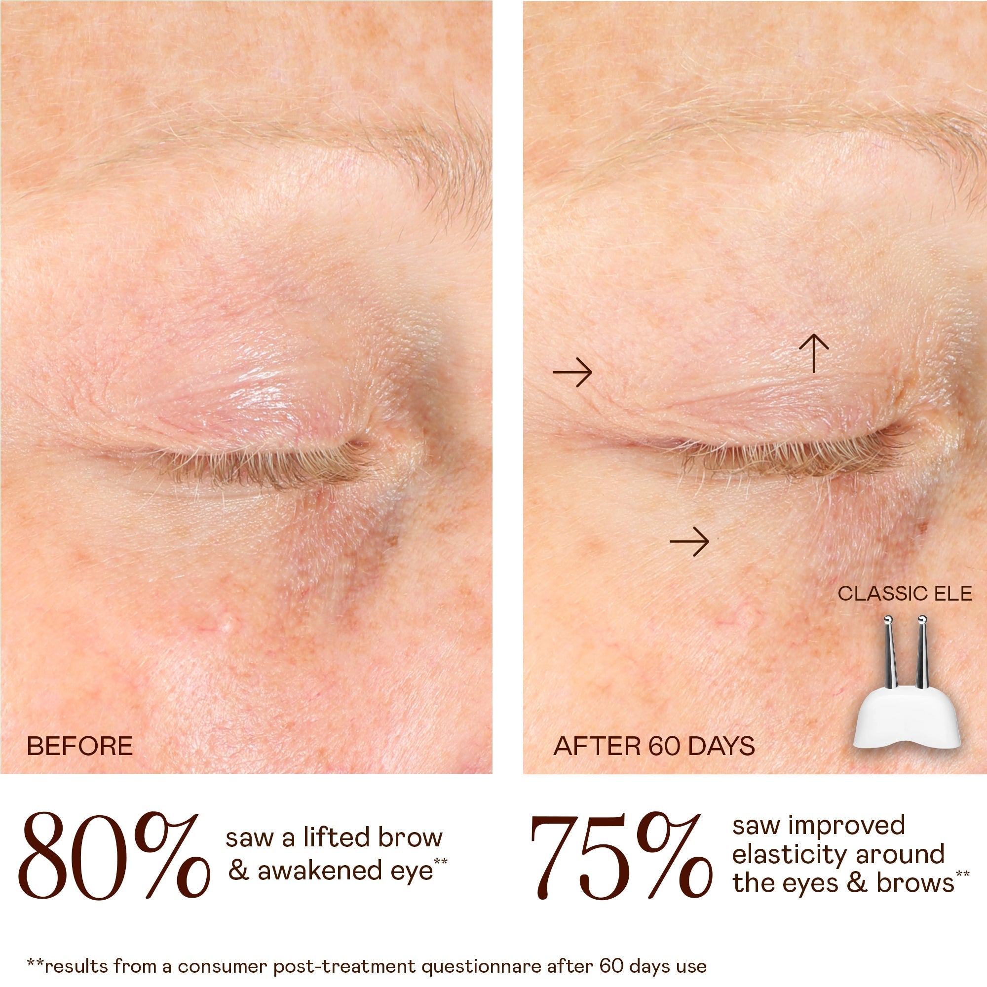 TRINITY CLassic Lifting & Smoothing Lip & Eye Microcurrent Attachment
