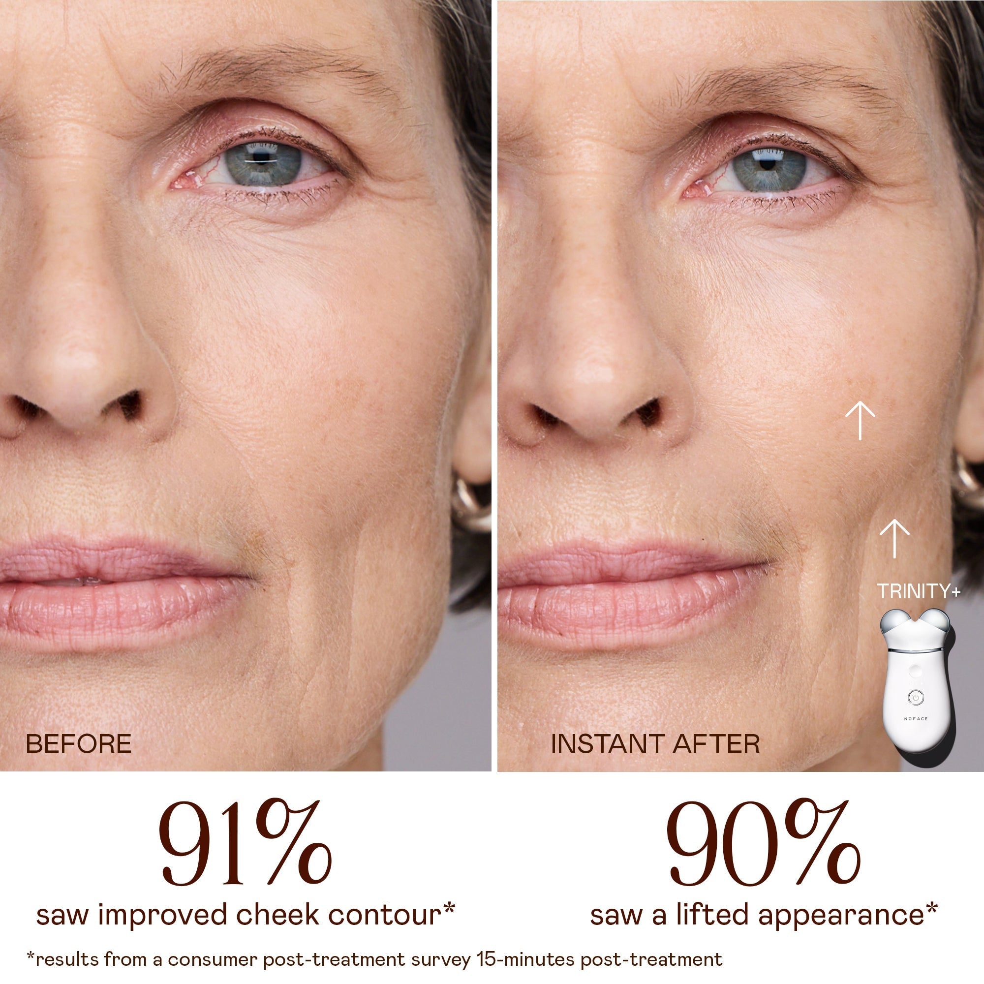 TRINITY+ Starter Kit - Pro-Longevity Microcurrent Facial Lifting Device