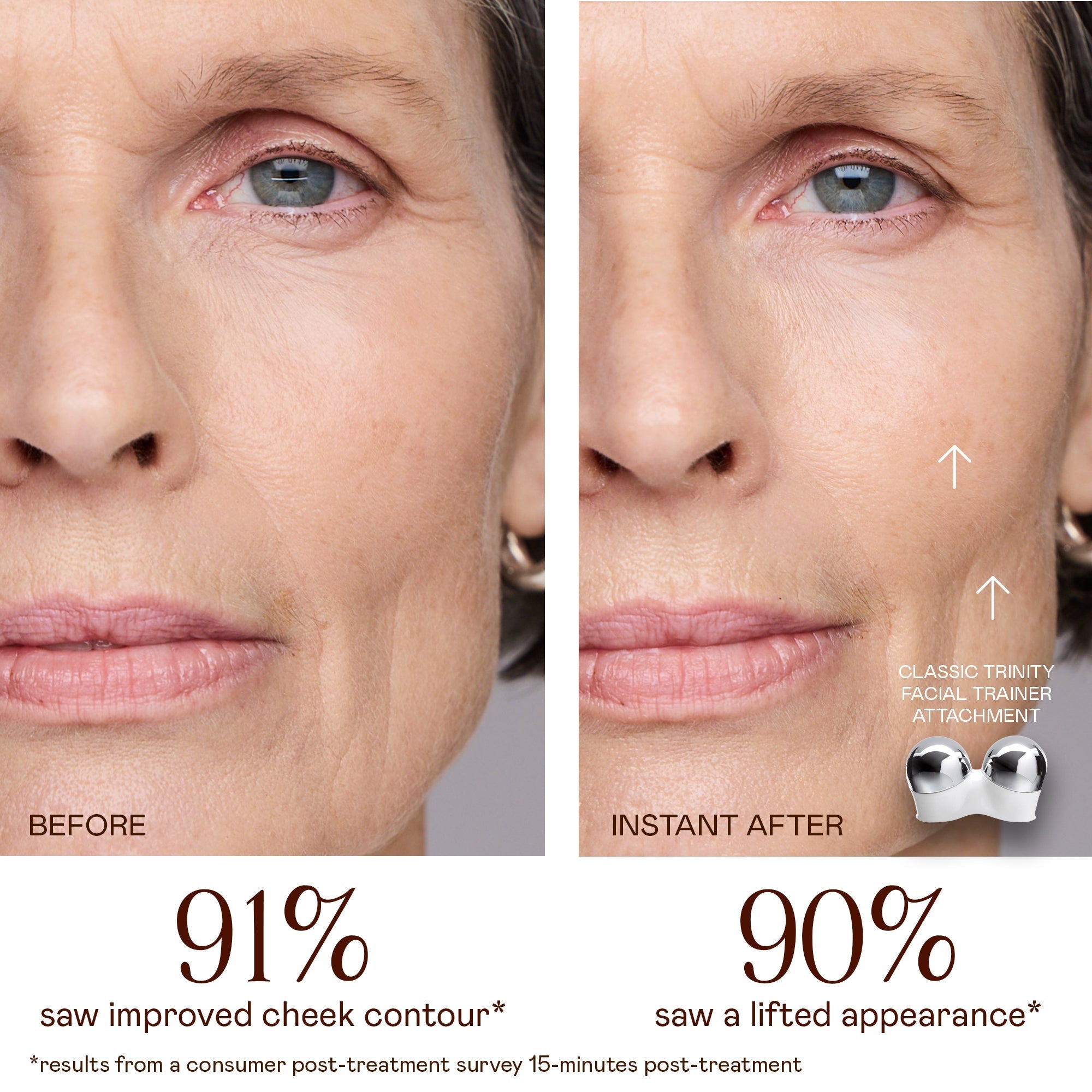 Trinity Classic Facial Trainer - Replacement Attachment for Trinity Classic