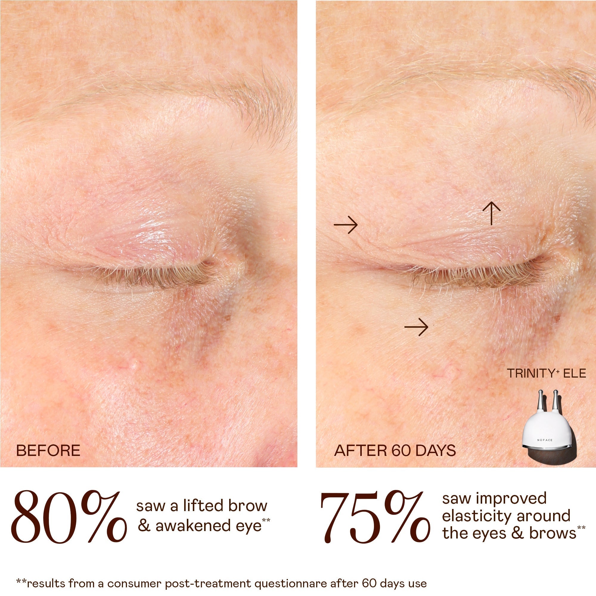 TRINITY+ Lifting & Smoothing Lip & Eye Microcurrent Attachment