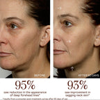MINI+ Starter Kit - Petite Pro-Longevity Microcurrent Facial Sculpting Device